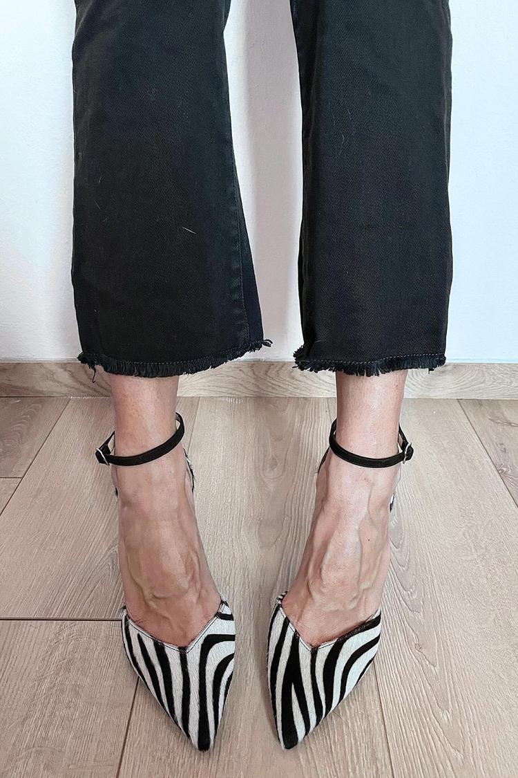 Lydia | Zebra Print Pumps With Ankle Strap